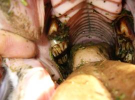 Patient with irregular bite