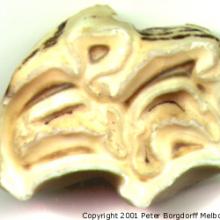 Upper Molar Occlusal Surface